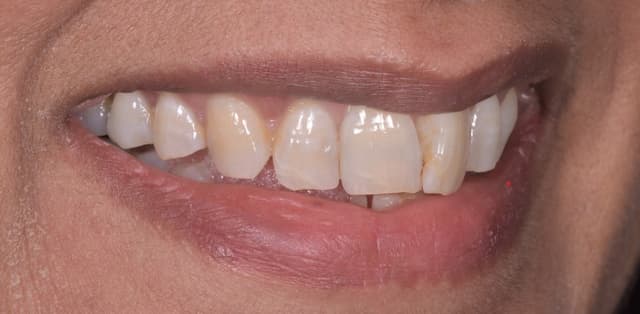 Before